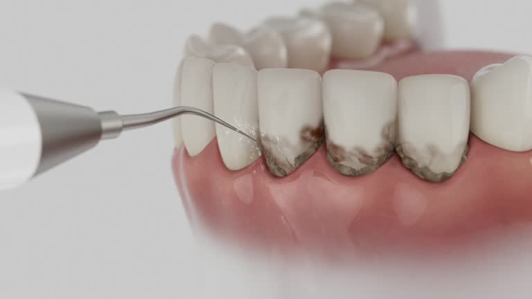 Trusted Dental Crowns And Bridges service in Muskegon, MI - Dentist Open Now
